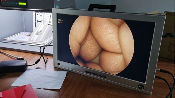 Full HD 1080P 4 in 1 ระบบกล้องเอนโดสโคปทางการแพทย์แบบพกพาในตัวหนึ่งเดียว