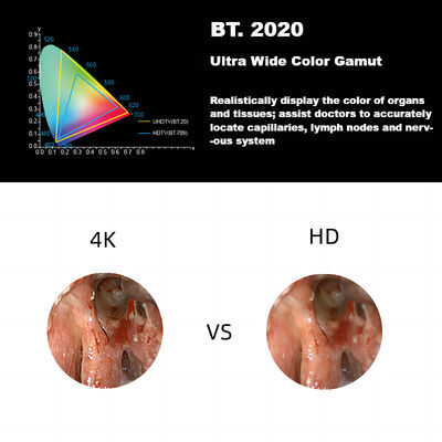 DEC 3840A ระบบกล้องเอนโดสโคปทางการแพทย์ 4K Ultra HD ใหม่สำหรับการส่องกล้อง